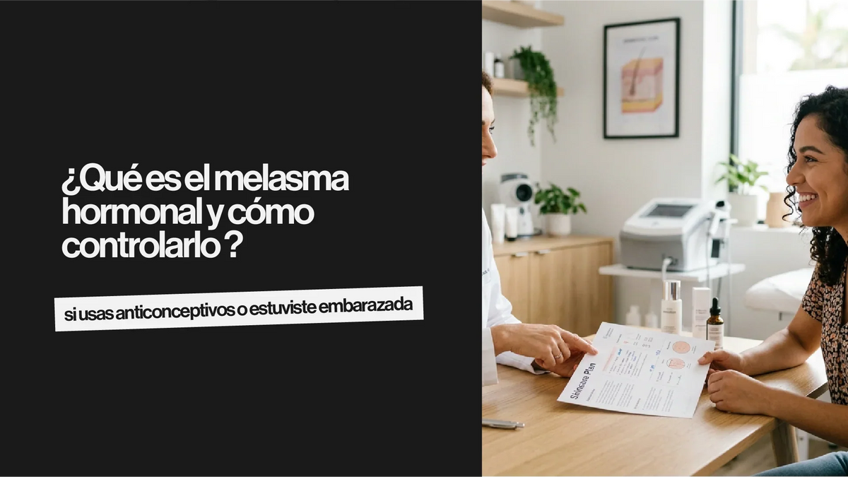 ¿Qué es el melasma hormonal y cómo controlarlo si usas anticonceptivos o estuviste embarazada?