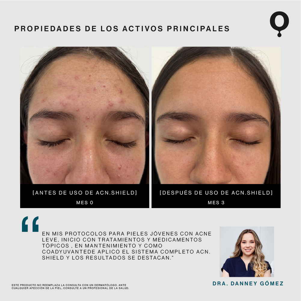 Acn.Shield Serum Reparador de Imperfecciones