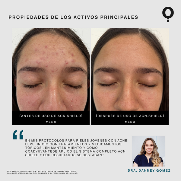 Acn.Shield Serum Reparador de Imperfecciones