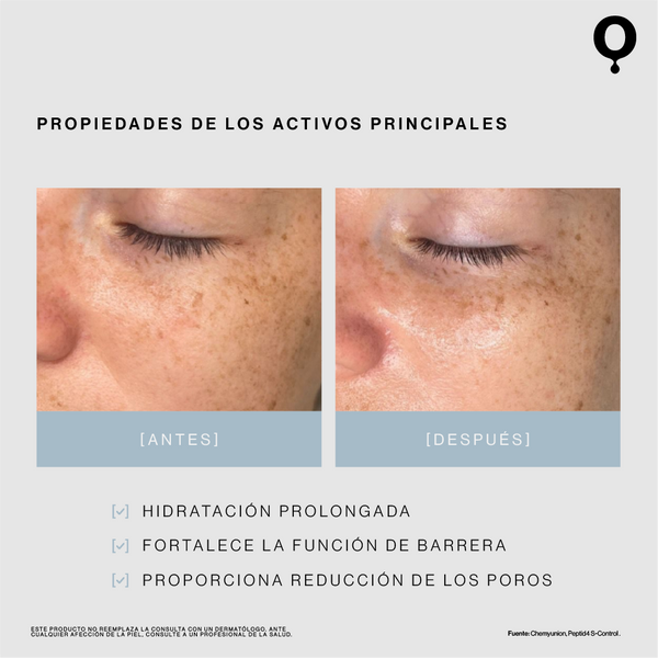 Hidratante facial (Piel Mixta a Grasa)