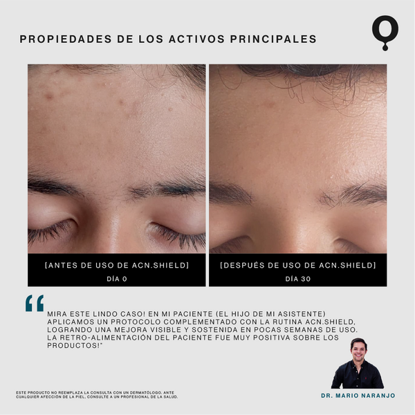 Acn.Shield Limpiador Facial Seborregulador