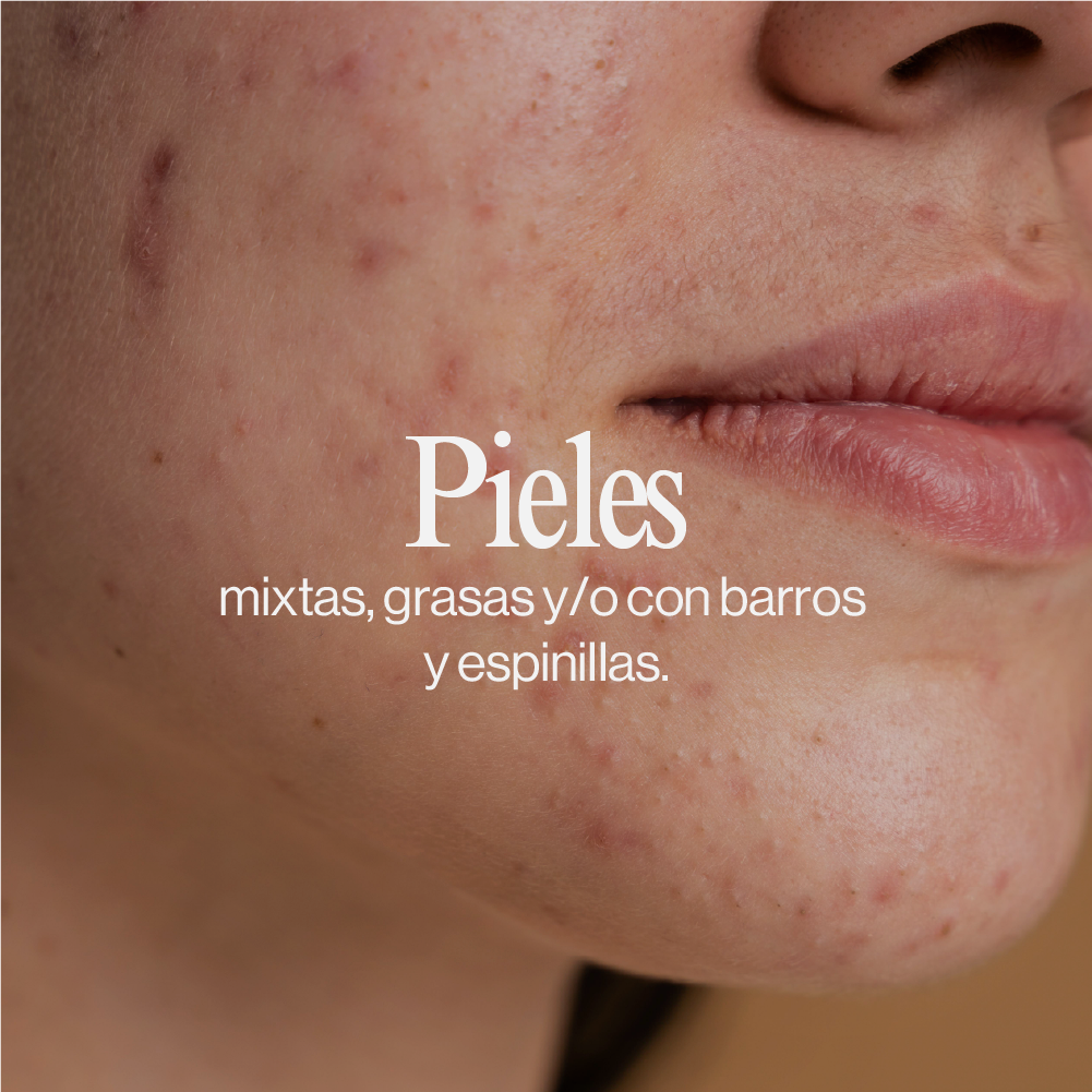 Acn.Shield Serum Reparador de Imperfecciones