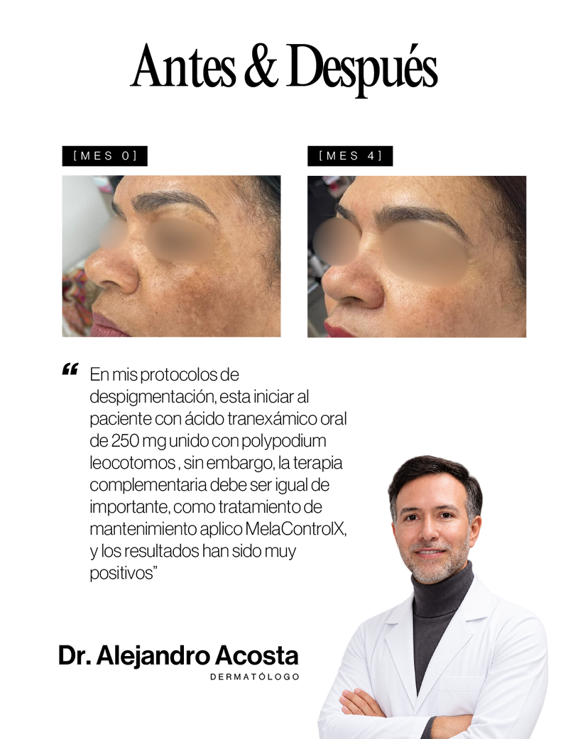 Caso médico Antes y Después