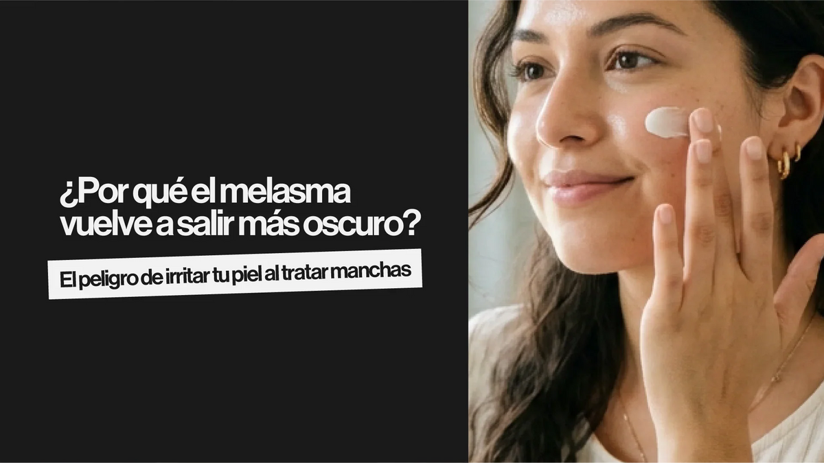 ¿Por qué el melasma vuelve a salir más oscuro? El peligro de irritar tu piel al tratar manchas