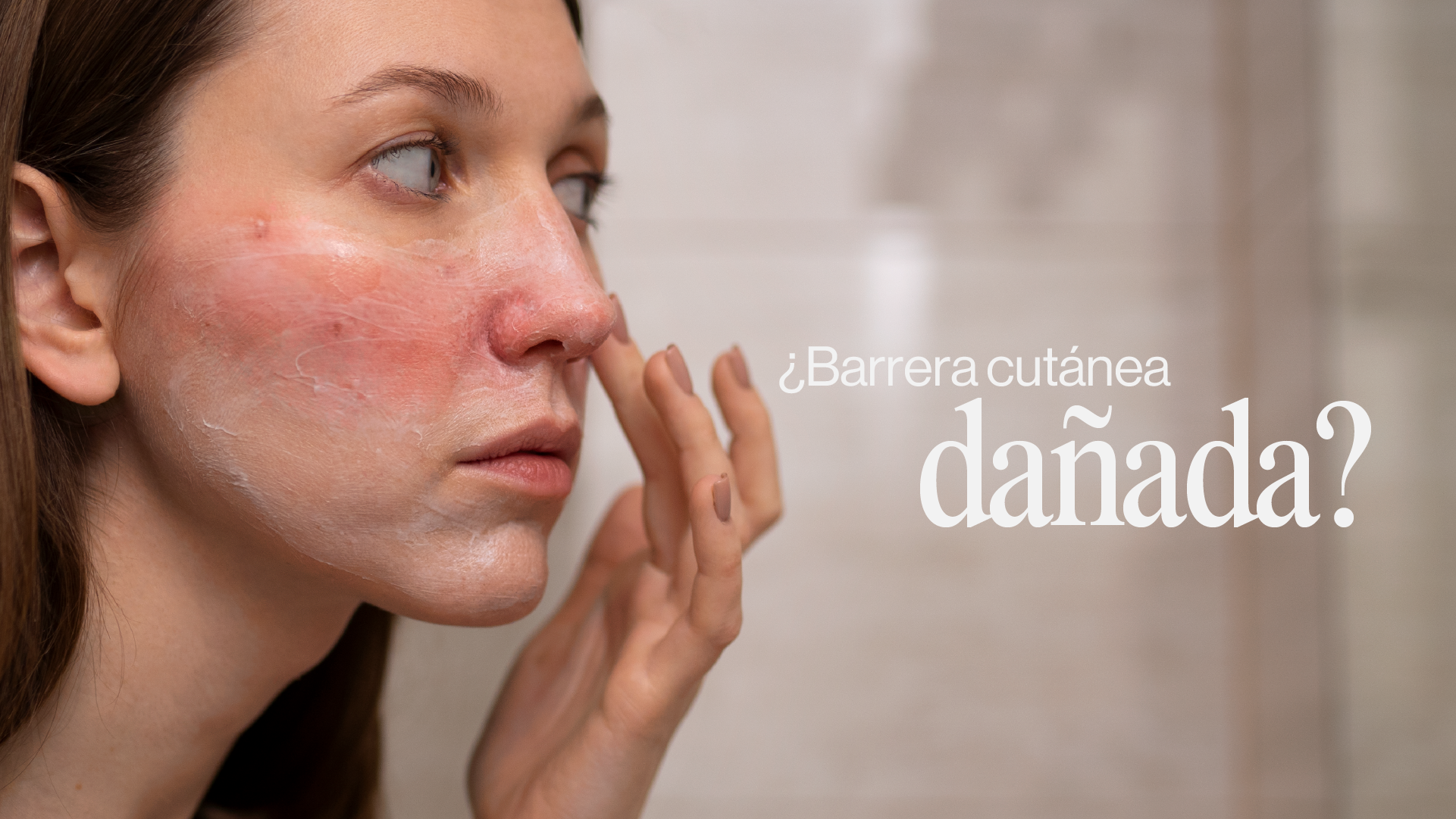 Barrera cutánea dañada: el error invisible que está empeorando tu acné y tus manchas