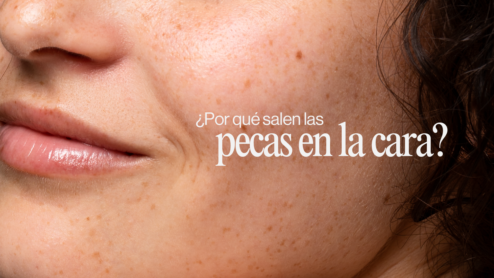Pecas en la cara: por qué salen, qué son las efélides y cómo cuidarlas