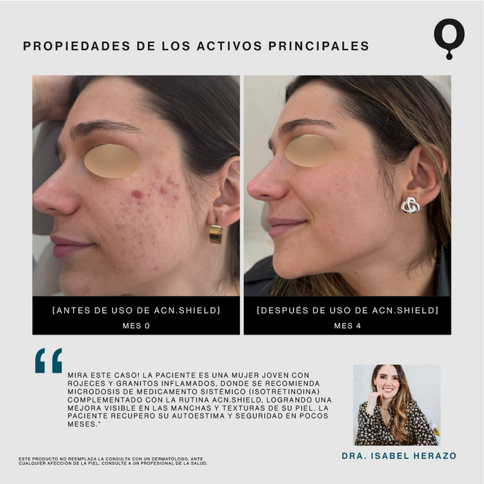 Kit Antiimperfecciones
