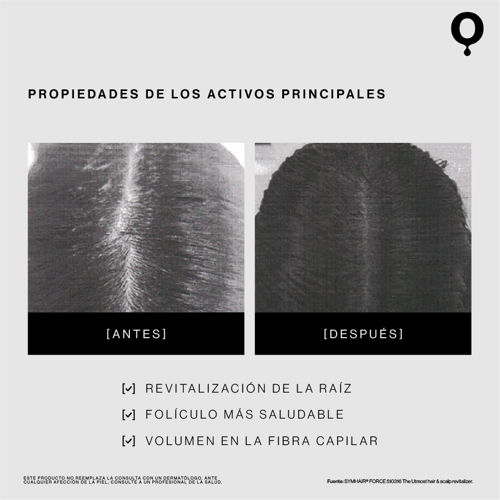 FoliGrow: Shampoo Triple-Acción Anticaída