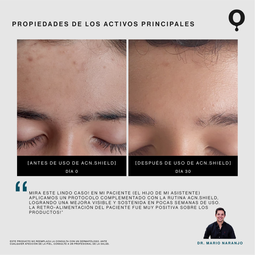 Acn.Shield Limpiador Facial Seborregulador