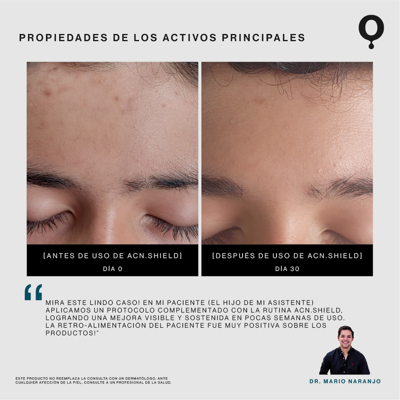 Acn.Shield Limpiador Facial Seborregulador