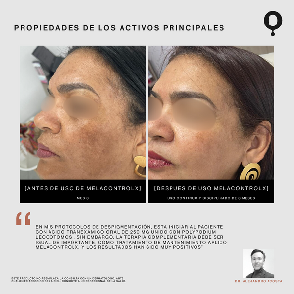 MelaControlX AM Serum Iluminador y Unificador de Tono