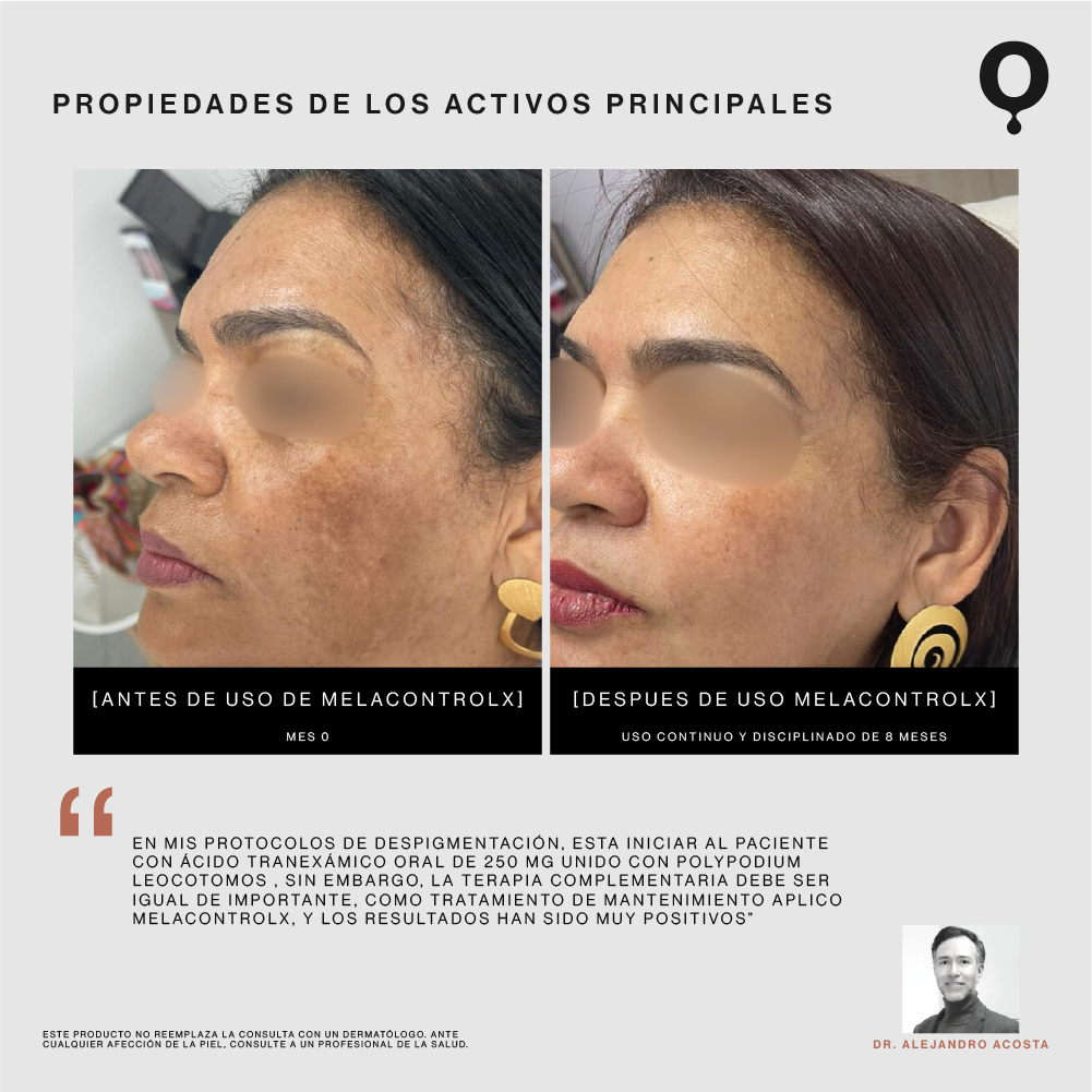 MelaControlX PM Serum Corrector y Restaurador de Tono