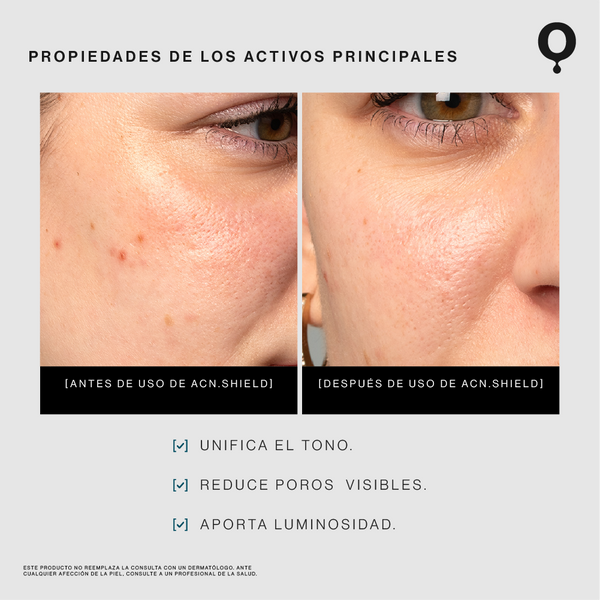 Parches Hidrocoloides para Minimizar Imperfecciones