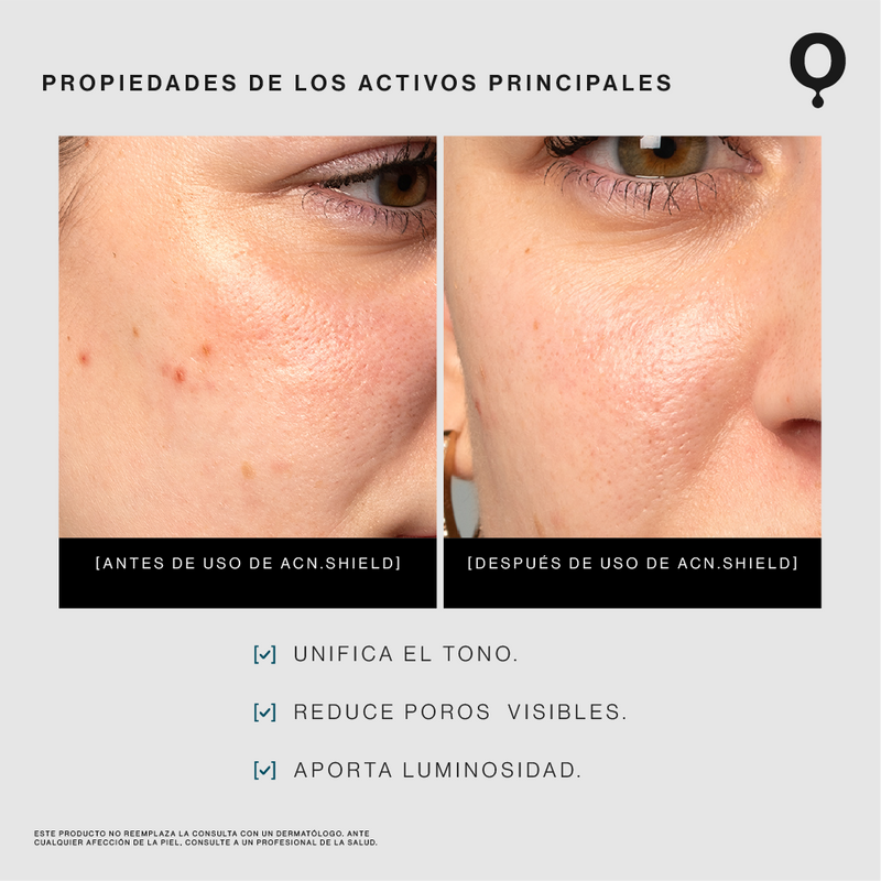 Parches Hidrocoloides para Minimizar Imperfecciones