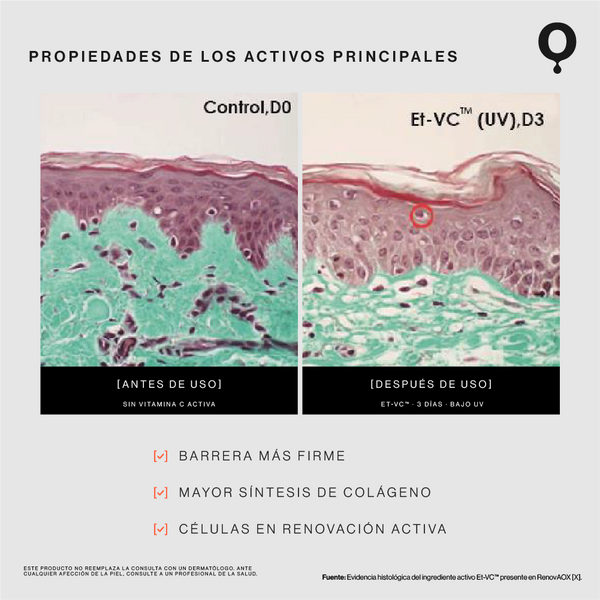 Serum Antioxidante con Vitamina C [15%]