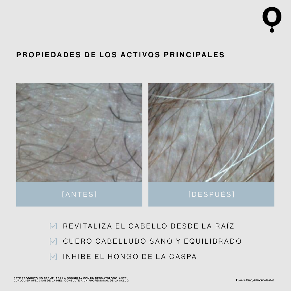 Shampoo Anticaida & Anticaspa