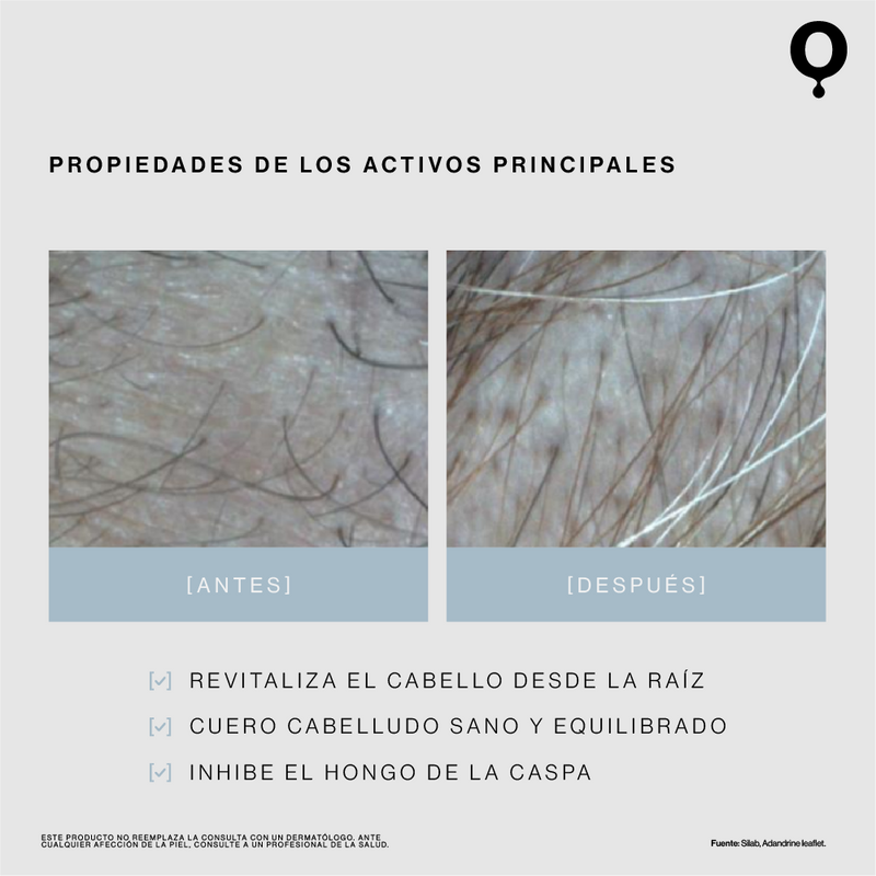 Shampoo Anticaida & Anticaspa