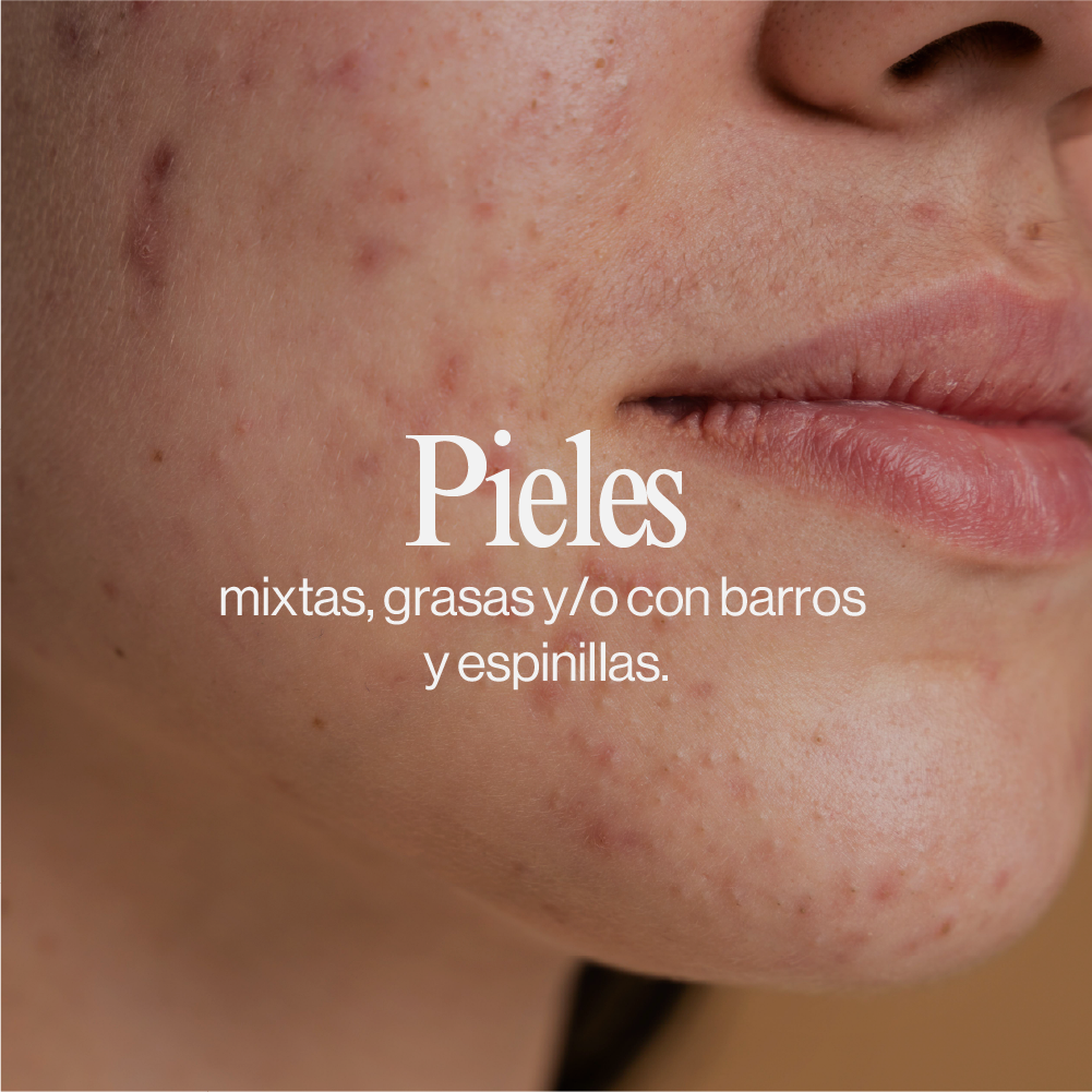 Acn.Shield Limpiador Facial Seborregulador