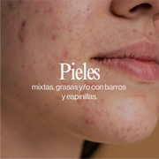 Acn.Shield Limpiador Facial Seborregulador