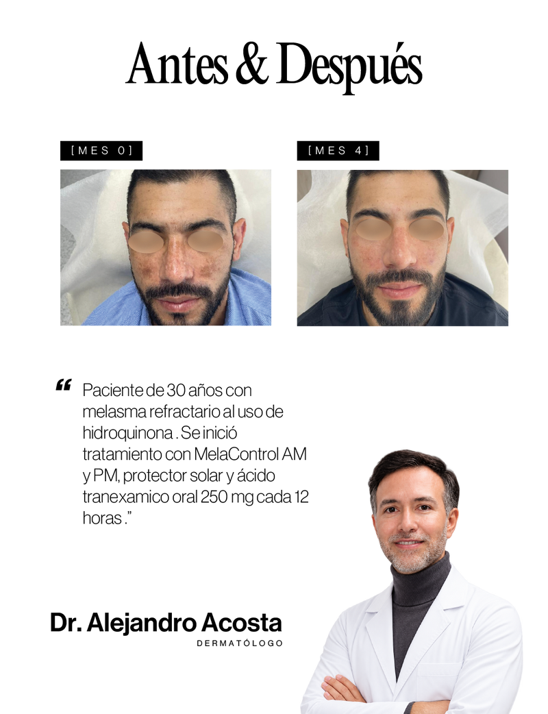 Caso médico Antes y Después