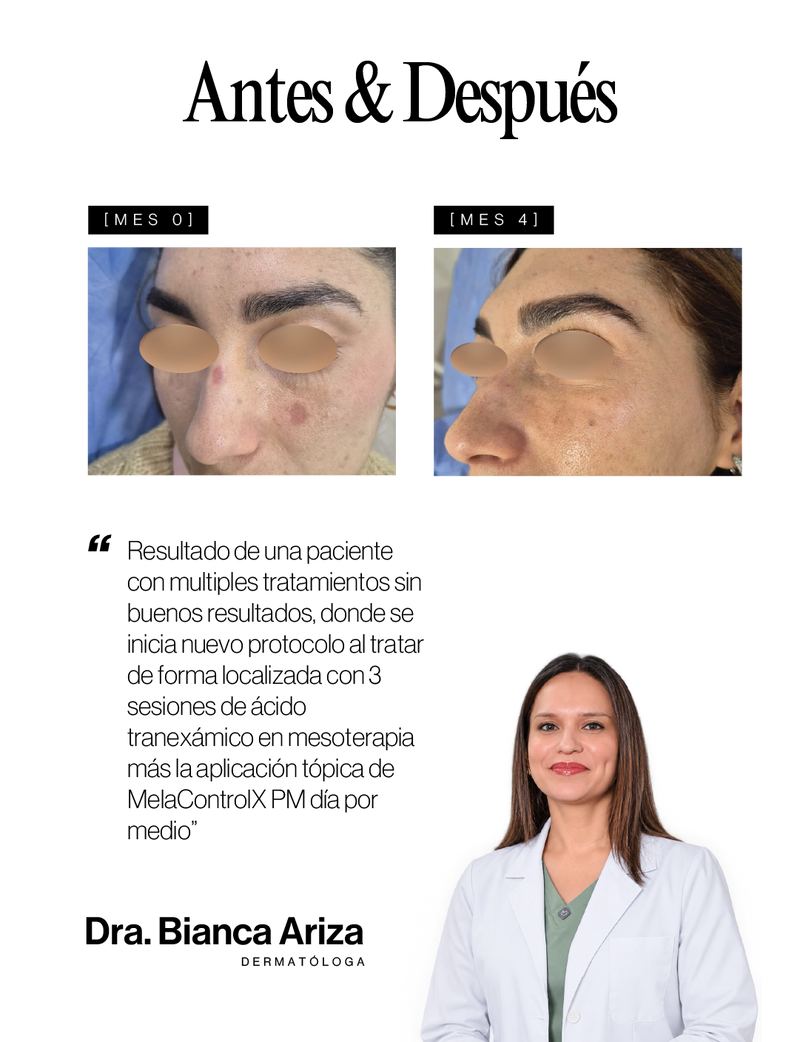 Caso médico Antes y Después