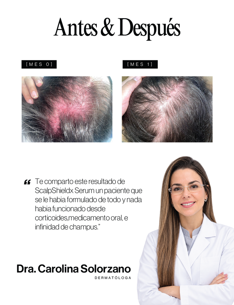 Caso médico Antes y Después