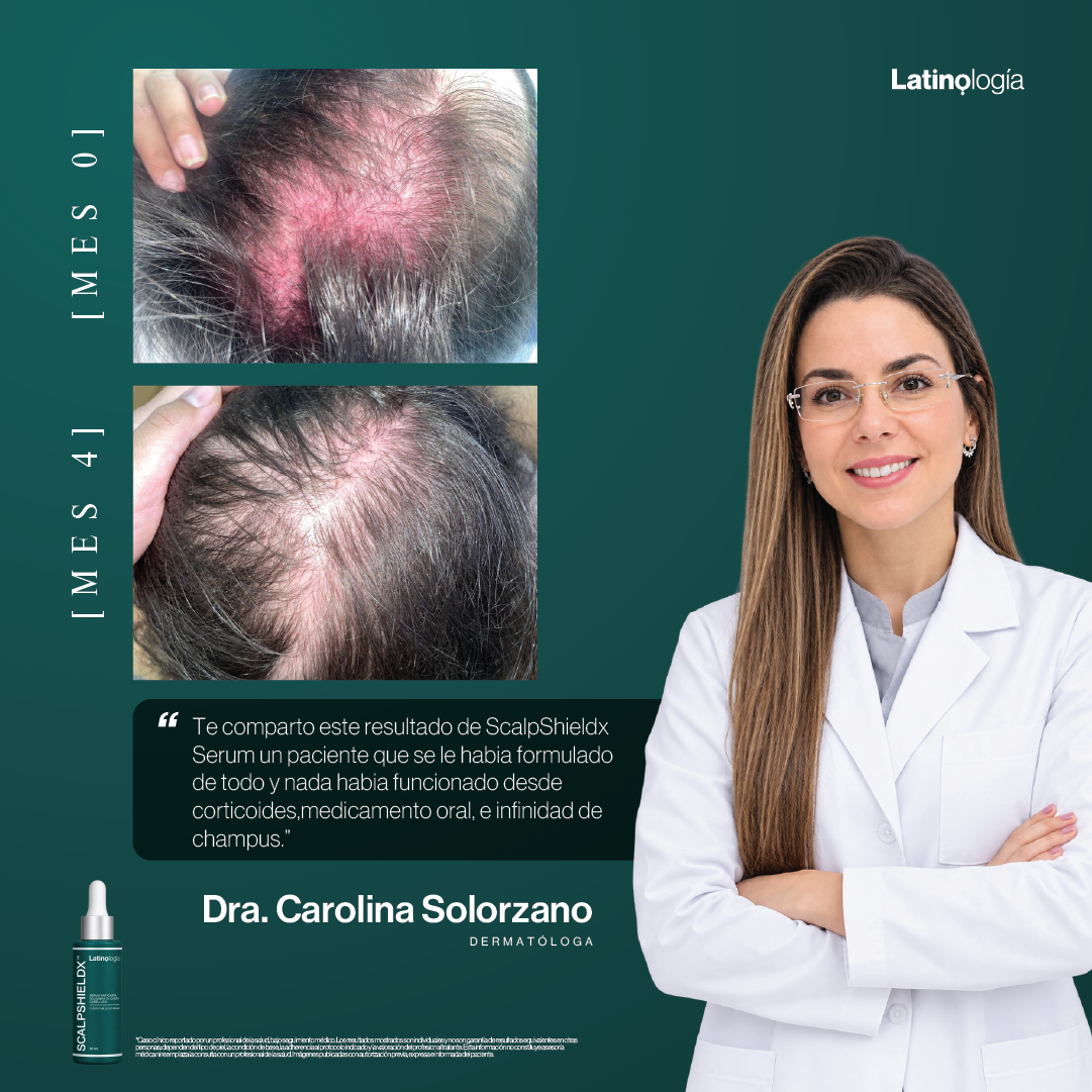 PELO MÁS FUERTE, DENSO Y UN CUERO CABELLUDO SALUDABLE