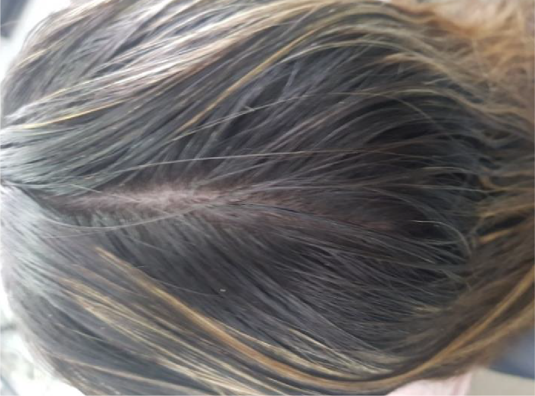 Antes
