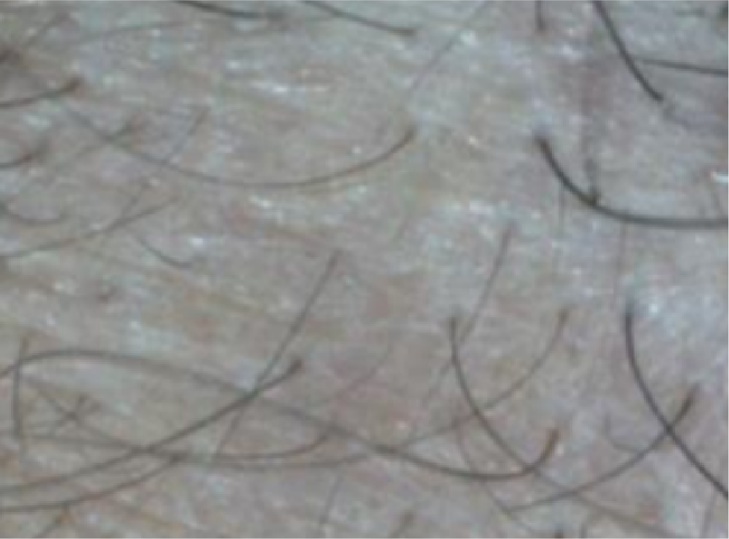 Antes
