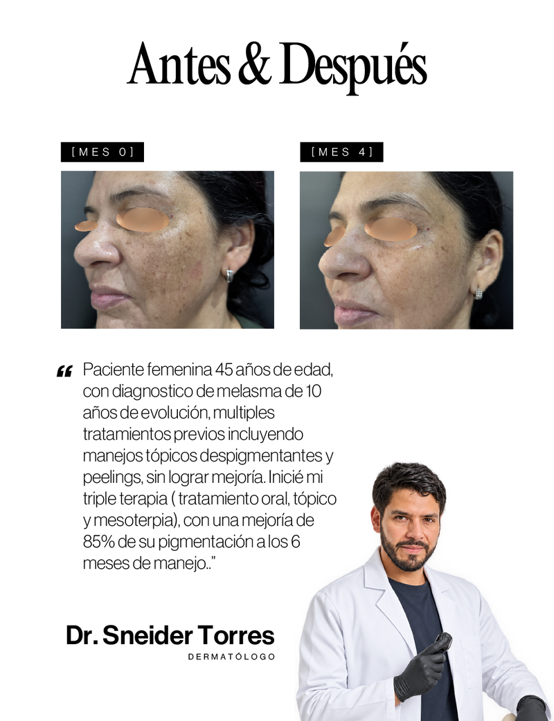 Caso médico Antes y Después